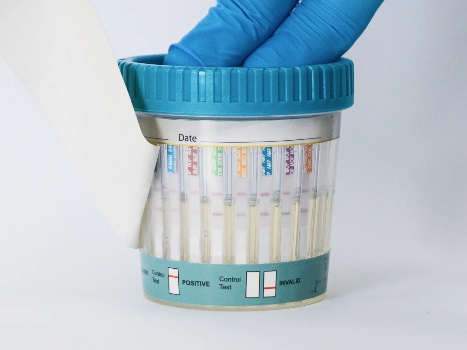 Exploring the Point of Care Urine Cup Test