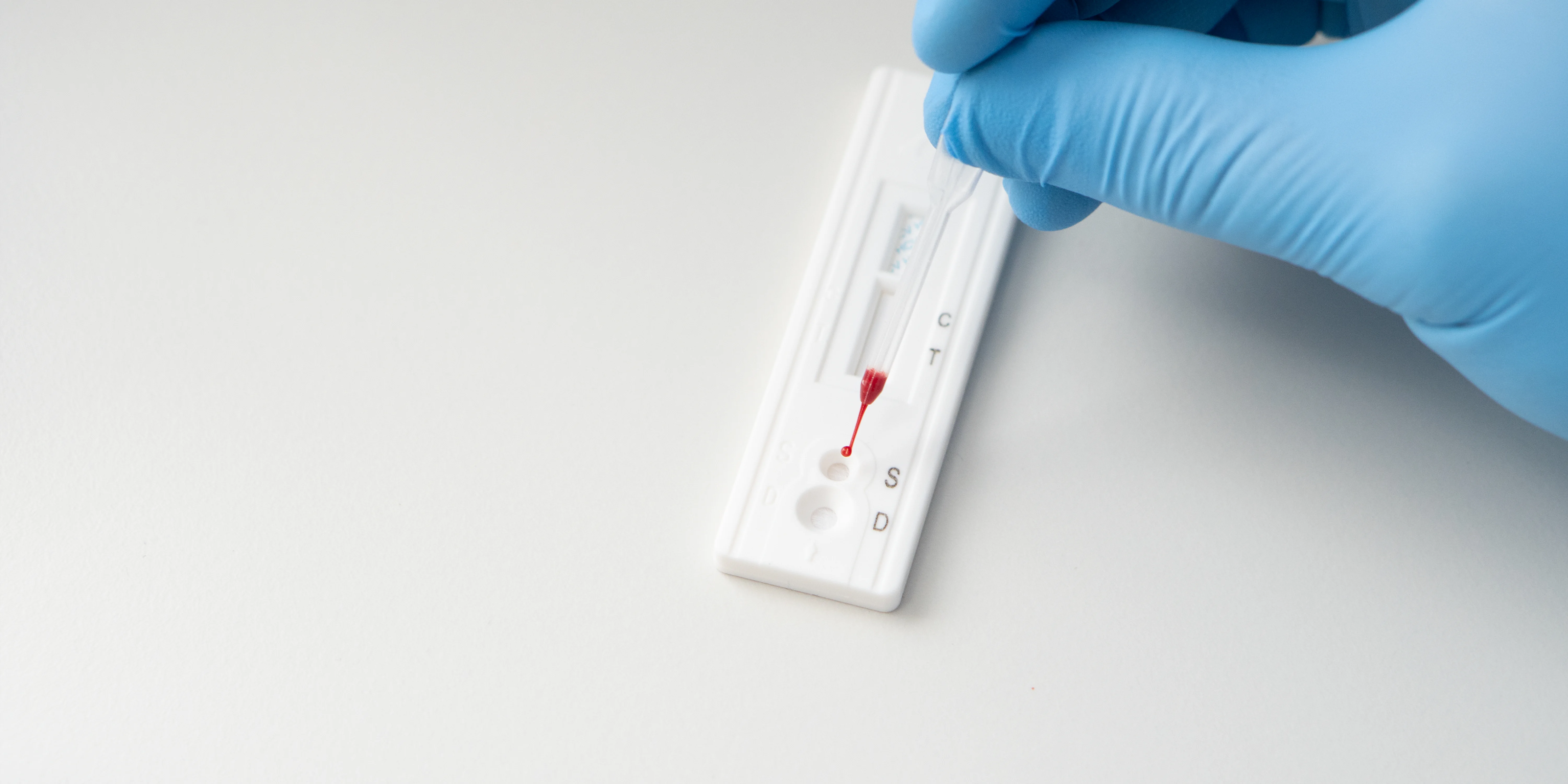 Understanding Bloodborne Virus (BBV) Testing: What It Is and How It's ...