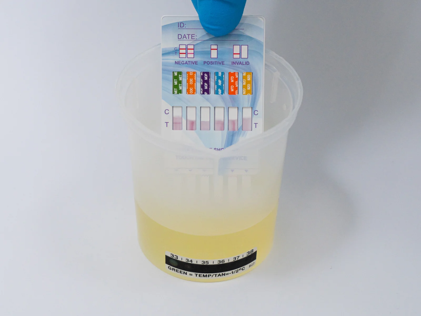 Exploring the Urine Dip Card Test